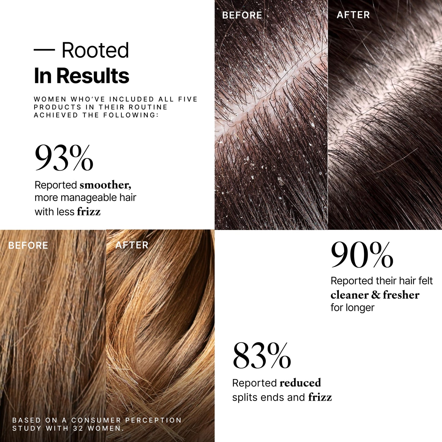 My Way Hair DNA Renewal Set - 5-Step System with Detox & Enhance Shampoos, Conditioner, Leave-In & Repair Oil - Deep Repair, Frizz Control, Shine