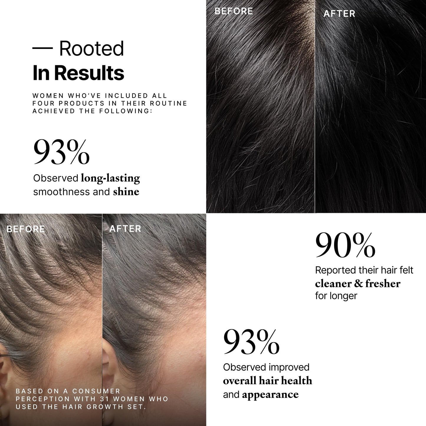 My Way Hair DNA Hair Growth Set - Scalp Detox Shampoo, Conditioner, Leave-In & Repair Oil System - Boosts Growth, Repairs Breakage, Hydrates