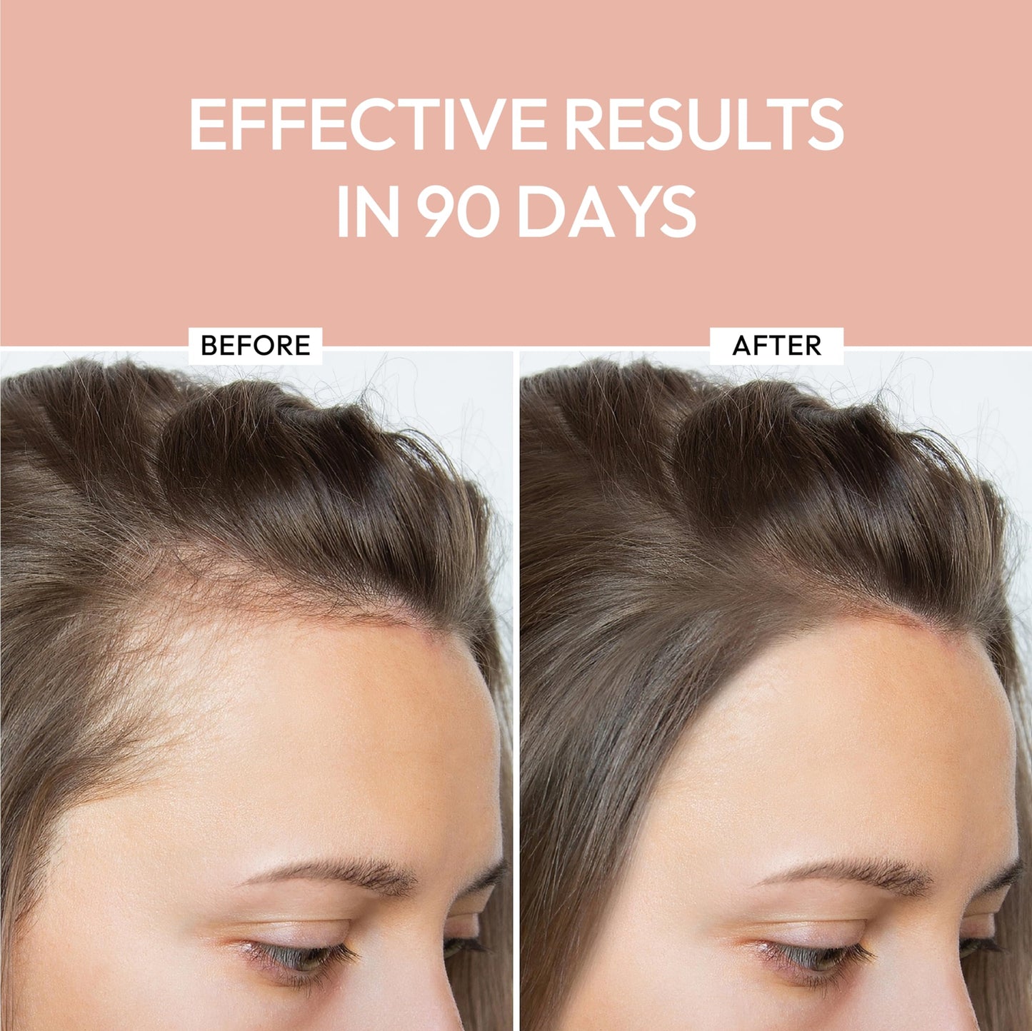 Luxe Cosmetics Hair Growth Serum (30ml) Advanced Formula for Hair Growth Product for Women - Supports Thicker, Fuller, and Shinier Hair - Premium