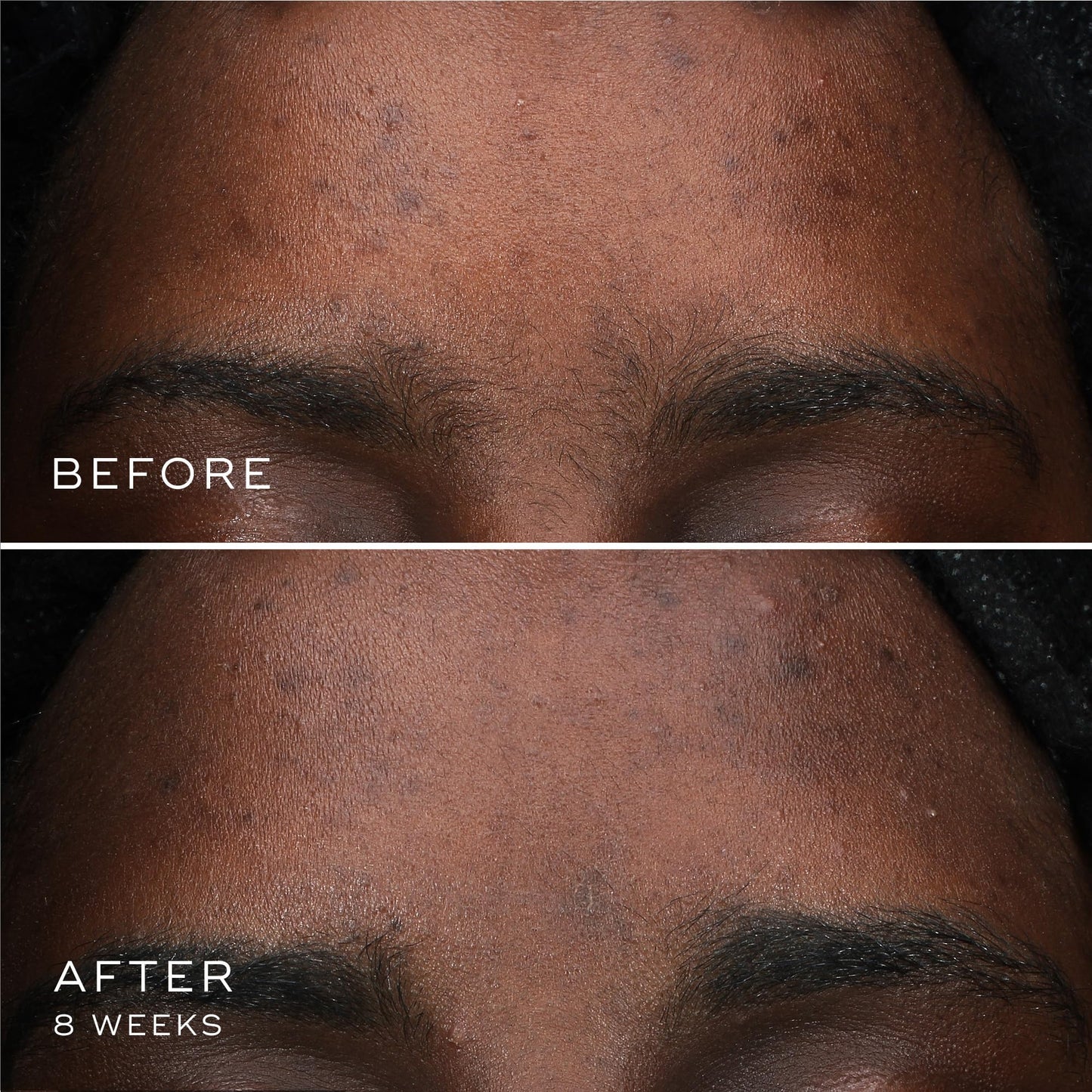 Medik8 Oxy-R Peptides Serum - Dark Spot Corrector With Twin Peptides - Face Serum For Women and Men - Gentle on Sensitive Skin - Gluten Free - 0.3 oz